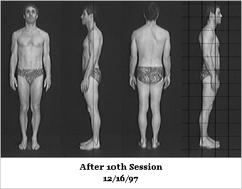 Rolfing After Photos