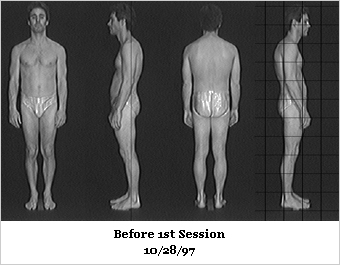 Rolfing After Photos